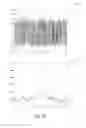 Fig. 75 - Electromagnetic sensing and detection of ingestible event markers