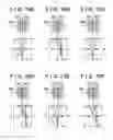 Fig. 10 - Image capturing apparatus, control method of controlling the same, and storage medium for determining reliability of focus based on vignetting resulting from blur