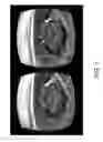 Fig. 02 - Methods and apparatus of viewport adaptive 360 degree video delivery
