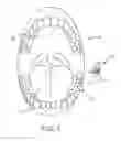 Fig. 02 - Actuator systems for oral-based appliances