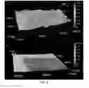 Fig. 09 - Hyperelastic binder for printed, stretchable electronics