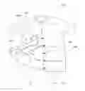 Fig. 01 - Postsurgical convalescence shirt