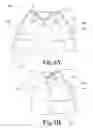 Fig. 06 - Postsurgical convalescence shirt