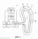 Fig. 02 - System and method for measuring and controlling foot temperature