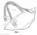 Fig. 02 - Clasp system for baggage items