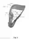 Fig. 22 - Customizable and stowable bodyrest