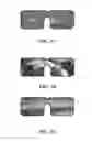 Fig. 08 - Head-mounted display for performing ophthalmic examinations