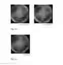 Fig. 16 - Wide field fundus camera with auto-montage at a single alignment