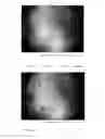 Fig. 19 - Wide field fundus camera with auto-montage at a single alignment