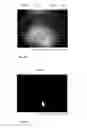Fig. 20 - Wide field fundus camera with auto-montage at a single alignment