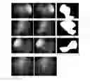 Fig. 28 - Wide field fundus camera with auto-montage at a single alignment