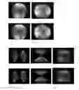 Fig. 29 - Wide field fundus camera with auto-montage at a single alignment