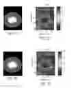 Fig. 11 - Automated time-domain determination of tissue viscoelasticity in a sub-hertz frequency range