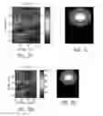 Fig. 13 - Automated time-domain determination of tissue viscoelasticity in a sub-hertz frequency range