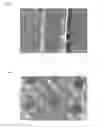 Fig. 02 - Echogenic article with compound indentations