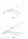 Fig. 08 - Suture passer/retriever