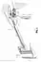 Fig. 02 - Surgical stapling instrument and associated trigger mechanisms