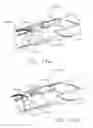 Fig. 106 - Clip applier comprising a reciprocating clip advancing member