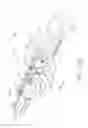 Fig. 113 - Clip applier comprising a reciprocating clip advancing member
