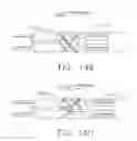 Fig. 115 - Clip applier comprising a reciprocating clip advancing member