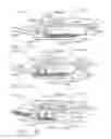 Fig. 130 - Clip applier comprising a reciprocating clip advancing member