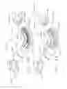 Fig. 99 - Clip applier comprising a reciprocating clip advancing member