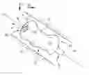 Fig. 01 - Inflatable and detachable balloon, designed to be implanted in a body cavity, associated treatment kit and draining method