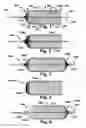 Fig. 02 - Method and apparatus for increasing blood flow through an obstructed blood vessel
