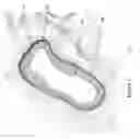 Fig. 02 - Identification of elastic lamina to guide interventional therapy