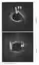 Fig. 06 - Identification of elastic lamina to guide interventional therapy