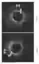 Fig. 07 - Identification of elastic lamina to guide interventional therapy