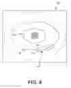 Fig. 33 - Identification of elastic lamina to guide interventional therapy