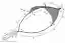 Fig. 01 - Endoscopic snare