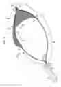 Fig. 02 - Endoscopic snare