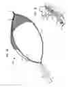 Fig. 08 - Endoscopic snare