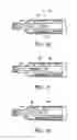 Fig. 16 - Tissue-removing catheter including operational control mechanism