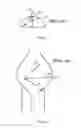 Fig. 02 - Apparatus and method for minimally invasive surgery