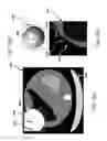 Fig. 09 - Automated image cropping for enhanced automatic device-to-image registration