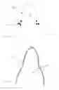 Fig. 05 - Dental preparation guide
