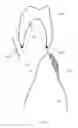Fig. 08 - Dental preparation guide