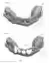 Fig. 10 - Dental preparation guide