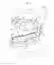 Fig. 02 - Orthodontic settling retainer