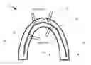 Fig. 01 - Teeth aligner system