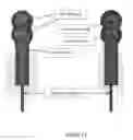 Fig. 09 - Teeth aligner system