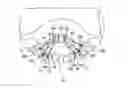 Fig. 01 - Palatal expansion device (palatal expander)