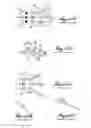 Fig. 07 - Palatal expansion device (palatal expander)