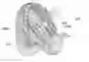 Fig. 01 - Maxillary expander