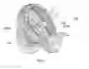 Fig. 07 - Maxillary expander