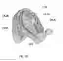 Fig. 09 - Maxillary expander