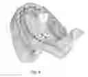 Fig. 22 - Maxillary expander